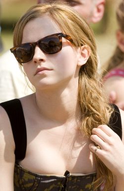 Emma Watson Needs Sunscreen
